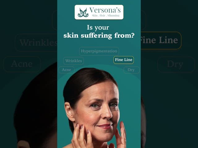 Hyperpigmentation, Acne, Wrinkles & Dry Skin? Get Expert Skin Treatment | Versona Clinic Hyderabad