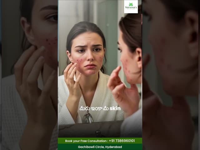 Skin Case Study by Expert Dermatologist | Personalized Skin Treatment | Versona Clinics, Hyderabad